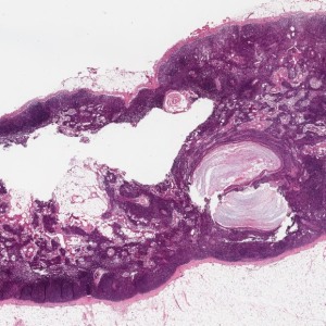 case 4