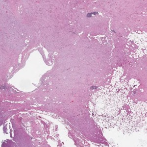 case 8