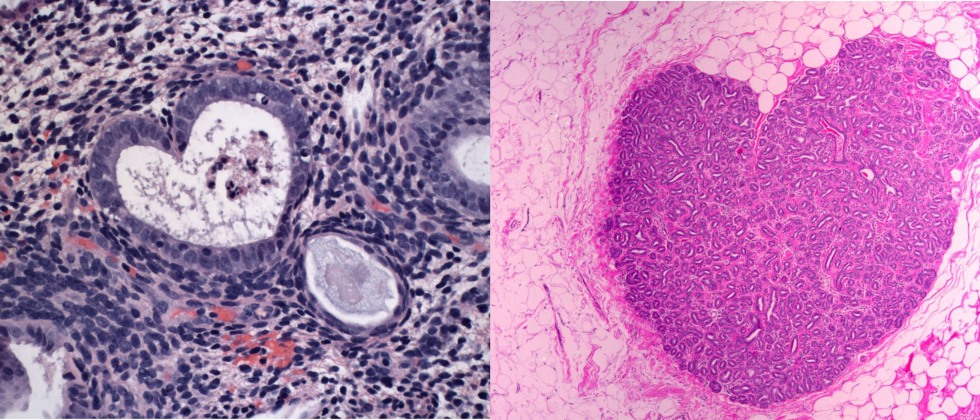 Women s Pathology Gynecologic Breast and Cytopathology